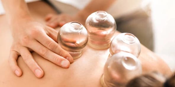 Three Cupping Sessions
