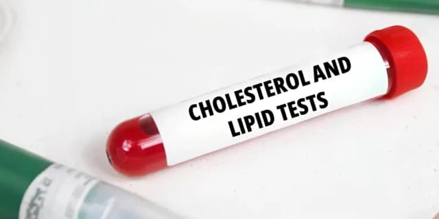 Lipid Panel